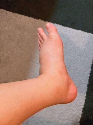 No.1「私の足じゃないみたい」産褥期のひどいむくみを楽にする3つの習慣